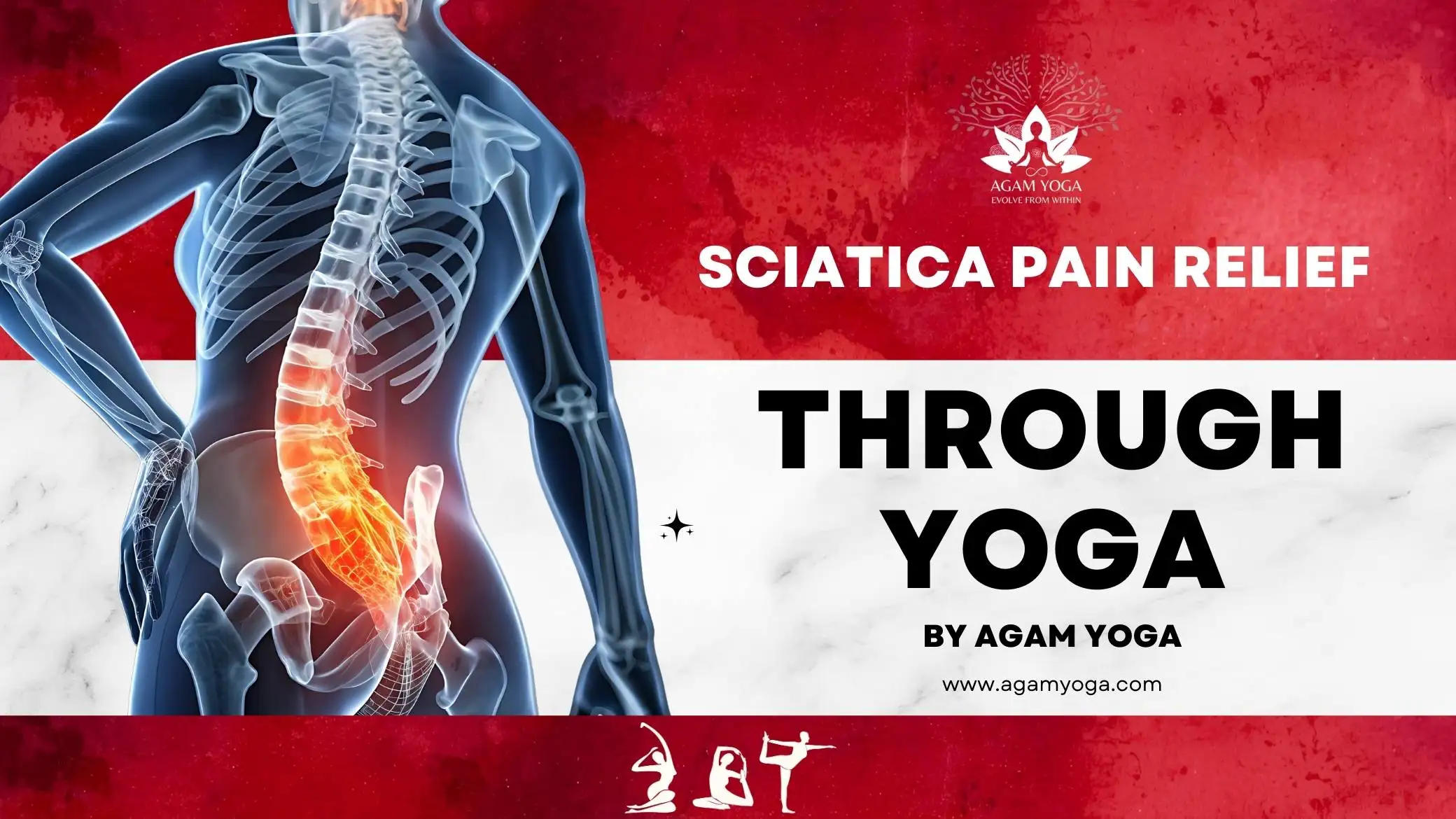 Sciatica Pain Relief Through Yoga: Best Asanas to Do and Asanas to Avoid